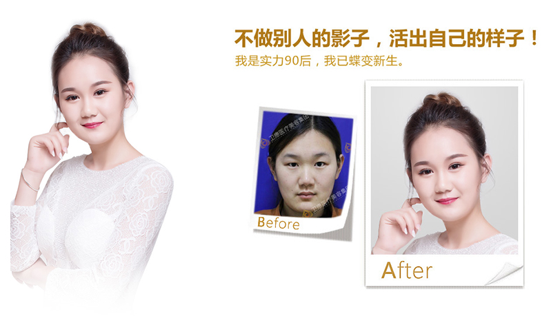 新竹纳米脂肪移植